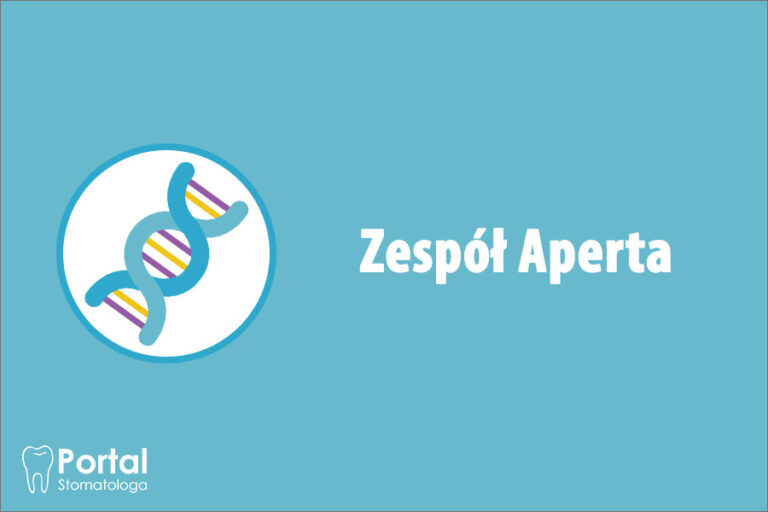 Zespół Aperta Portal Stomatologa