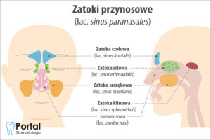 Zatoki przynosowe