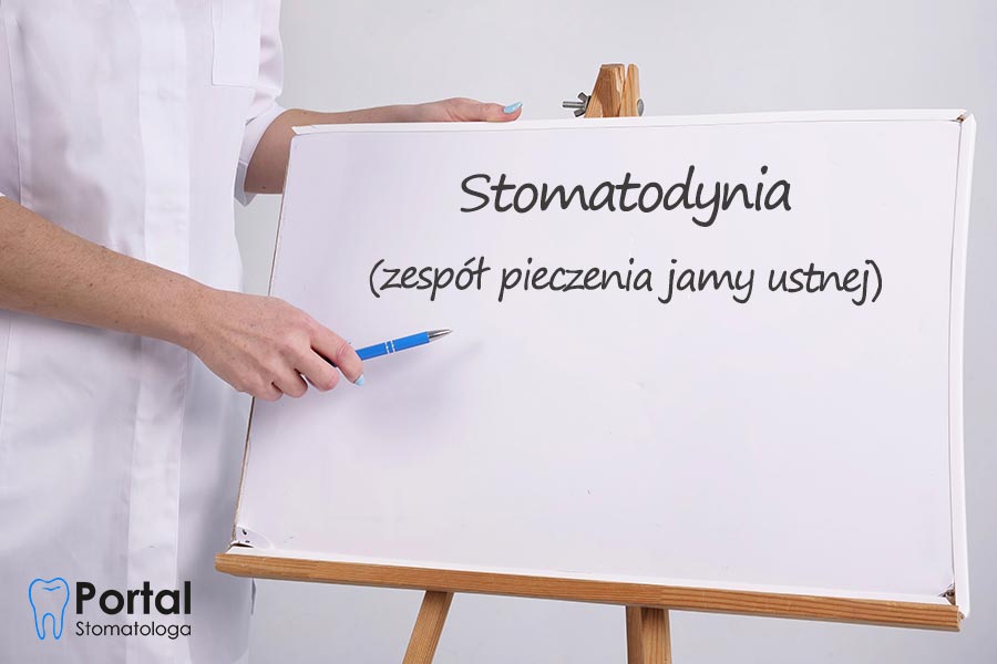 Stomatodynia (zespół pieczenia jamy ustnej)