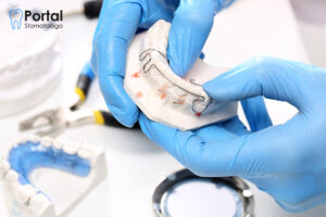 Dystalizacja zębów