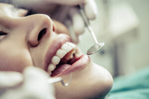 Dlaczego warto regularnie chodzić do dentysty?