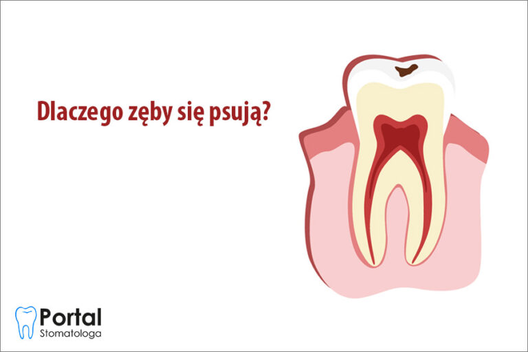 Dlaczego Zęby Się Psują Portal Stomatologa 8907