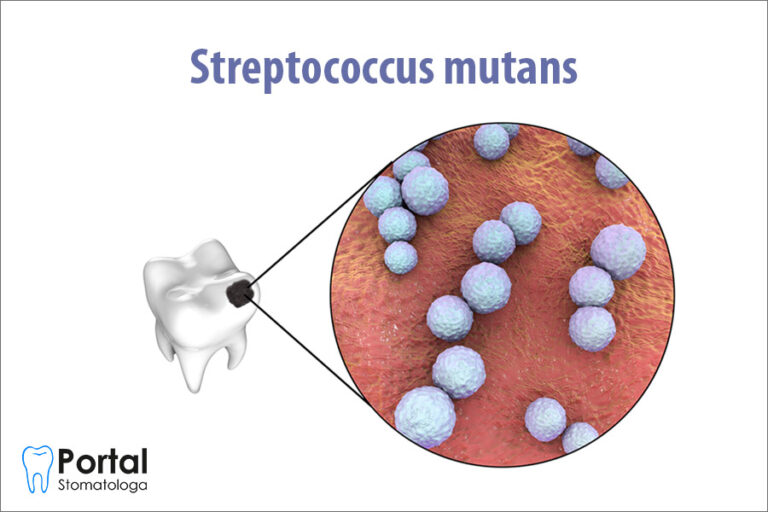 streptococcus-mutans-portal-stomatologa