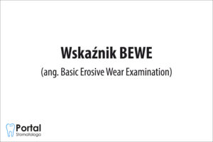 Wskaźnik BEWE (ang. Basic Erosive Wear Examination)