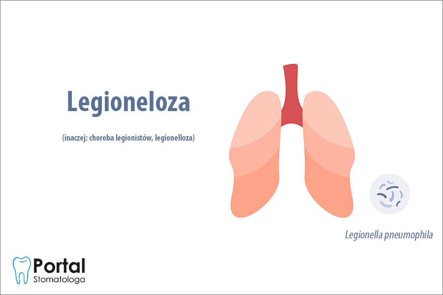 Legioneloza
