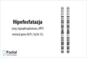 Hipofosfatazja