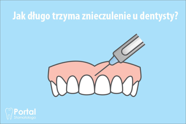 Jak długo trzyma znieczulenie u dentysty?