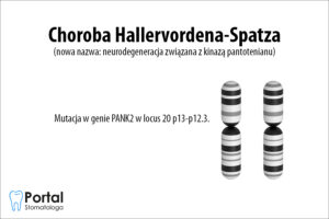 Choroba Hallervordena-Spatza