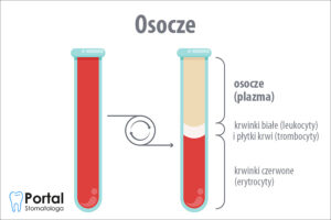 Osocze