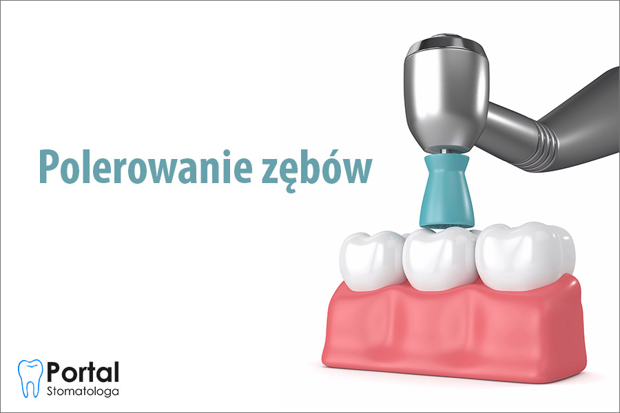 Polerowanie zębów