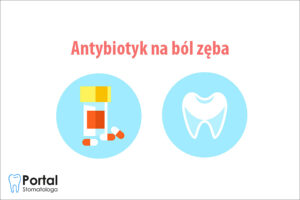 Antybiotyk na ból zęba