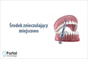 Środek znieczulający miejscowo