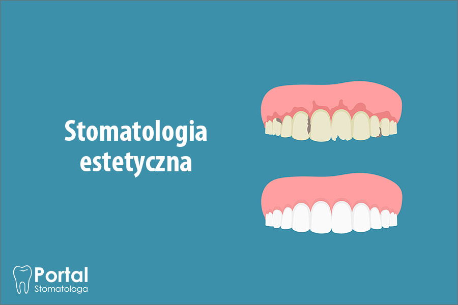 Stomatologia estetyczna