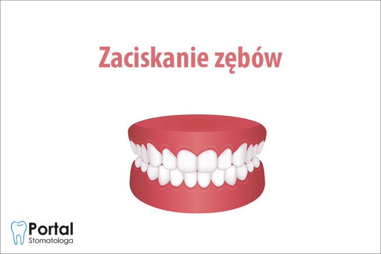 Zaciskanie zębów