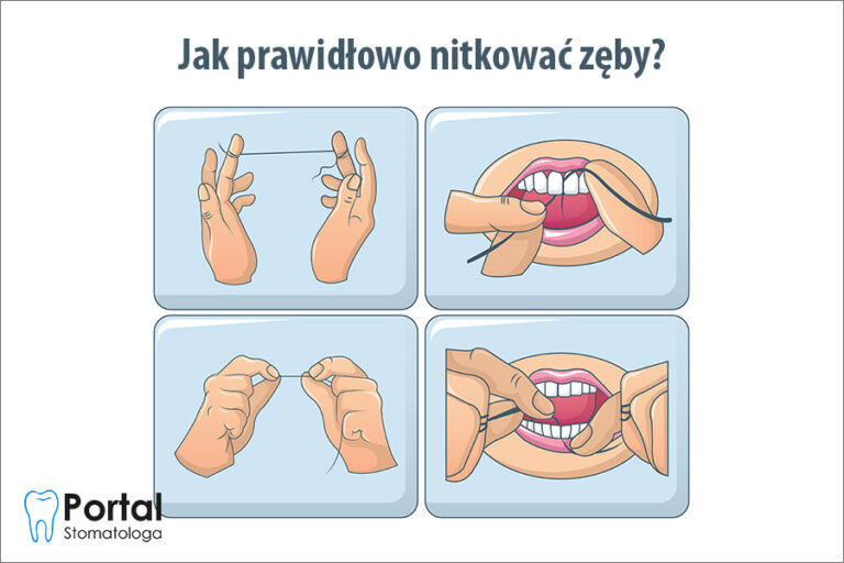 Jak prawidłowo nitkować zęby?