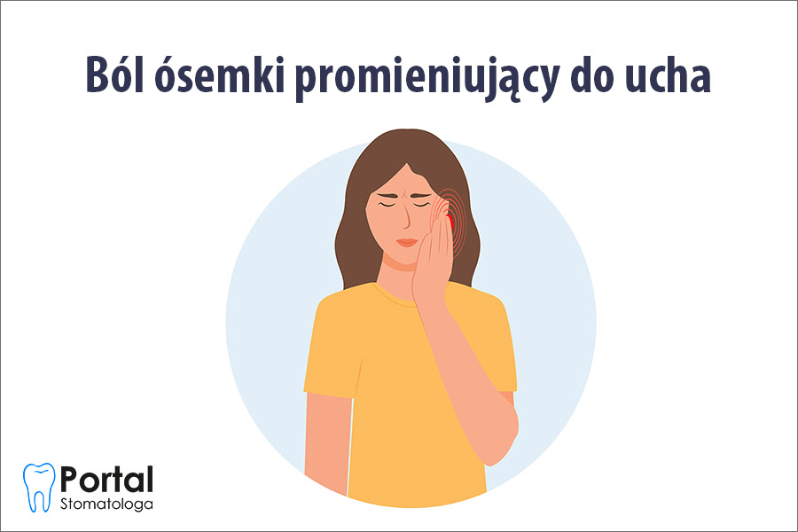 Ból ósemki promieniujący do ucha