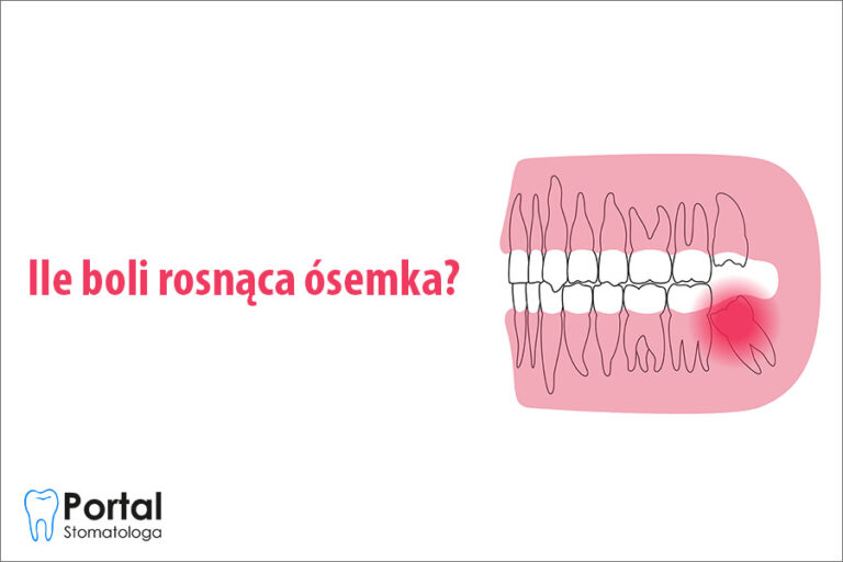 Ile boli rosnąca ósemka?