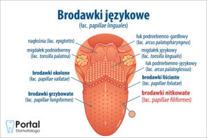 Brodawki nitkowate