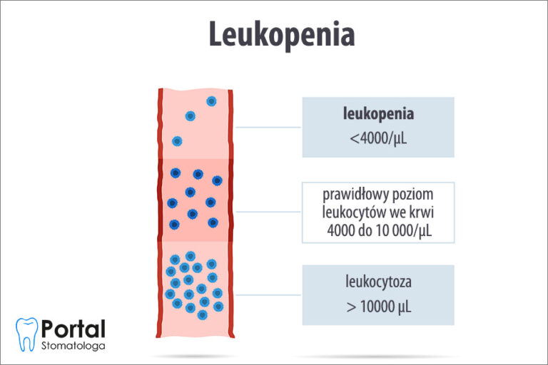 Leukopenia