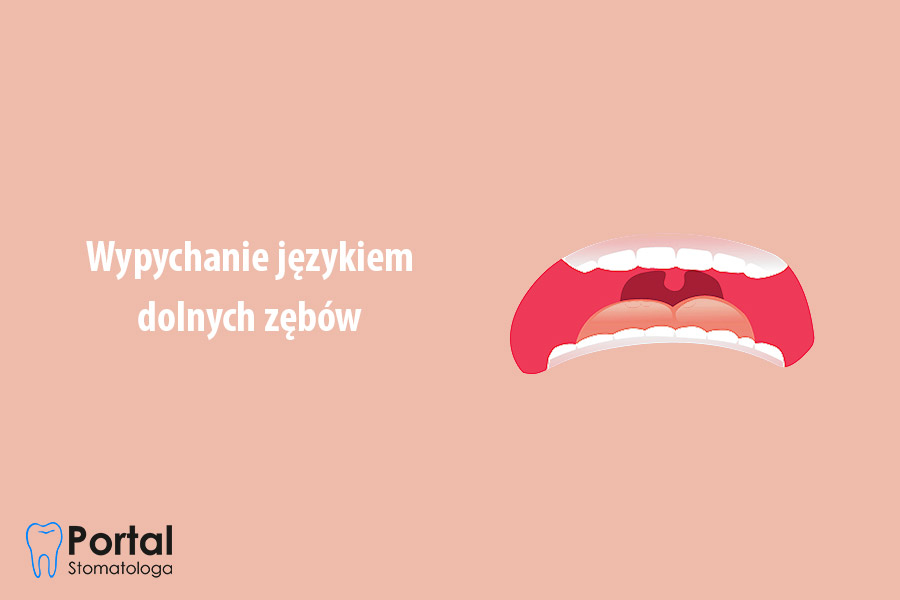 Wypychanie językiem dolnych zębów