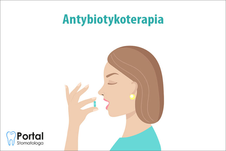 Antybiotykoterapia