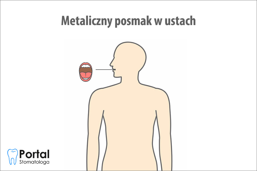 Metaliczny posmak w ustach