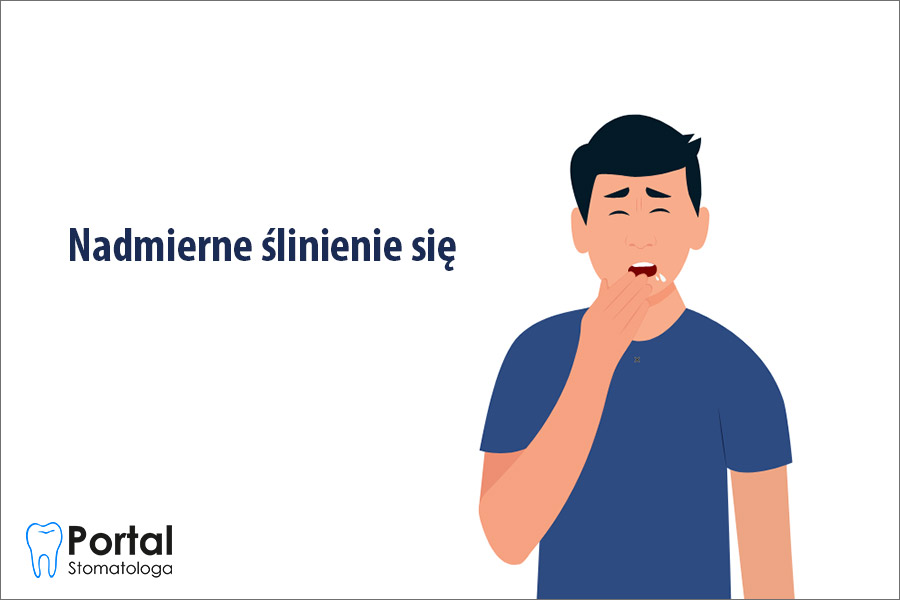 Nadmierne ślinienie się