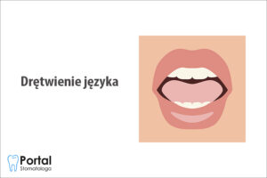 Drętwienie języka
