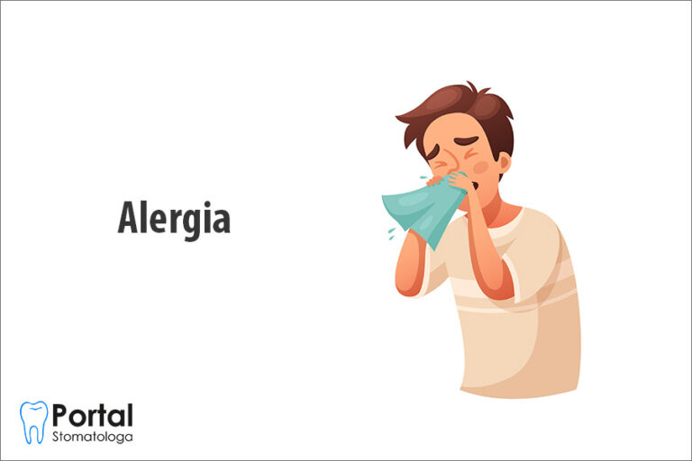 Alergia