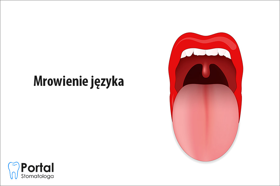 Mrowienie języka