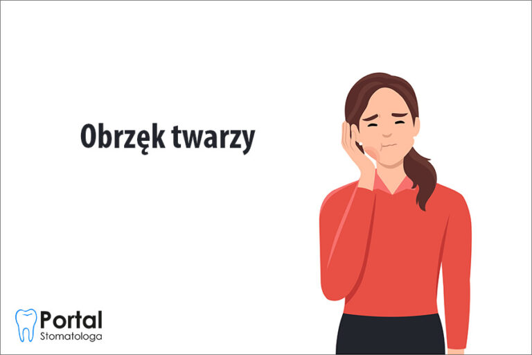Obrzęk twarzy