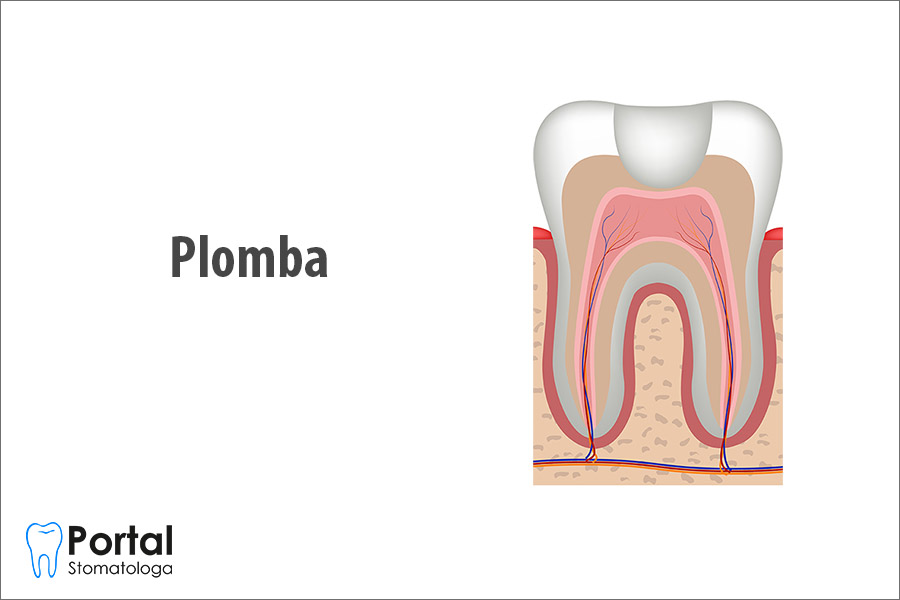 Plomba