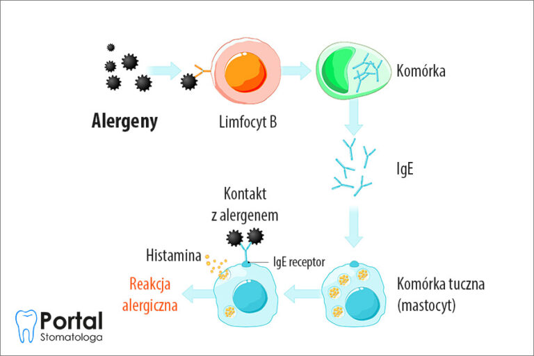 Alergen