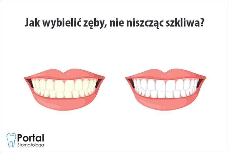 Jak wybielić zęby, nie niszcząc szkliwa?