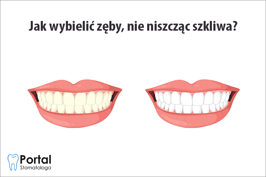 Jak wybielić zęby, nie niszcząc szkliwa?