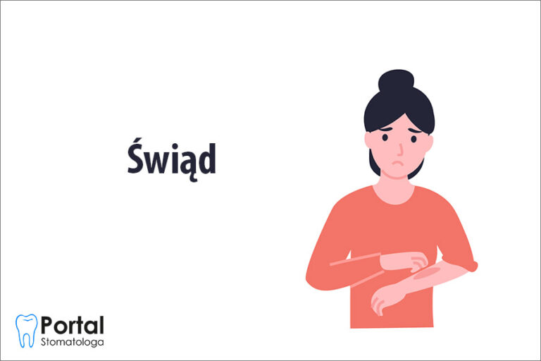 Świąd