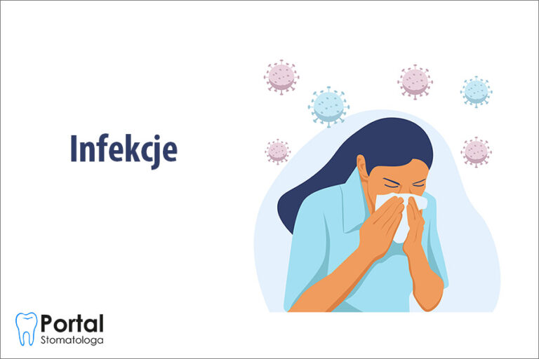 Infekcje
