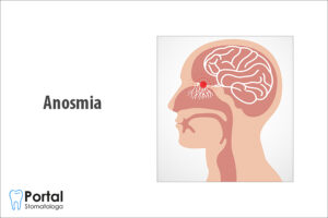 Anosmia