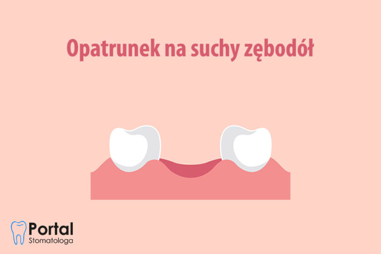 Opatrunek na suchy zębodół