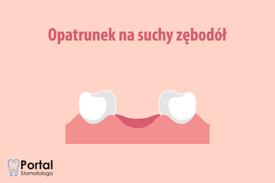 Opatrunek na suchy zębodół