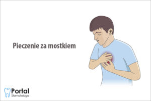 Pieczenie za mostkiem