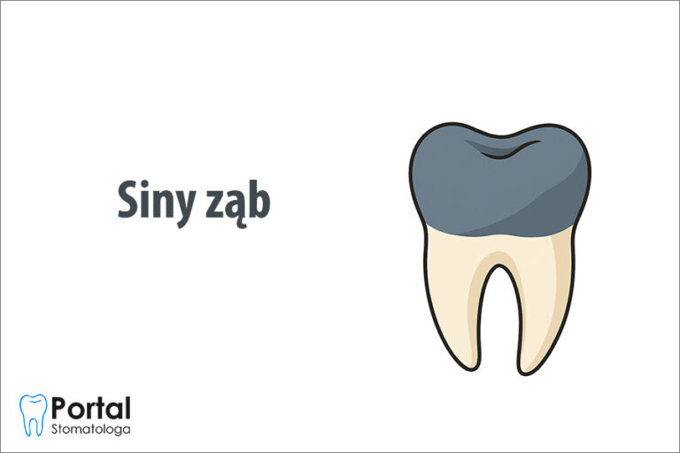 Siny ząb