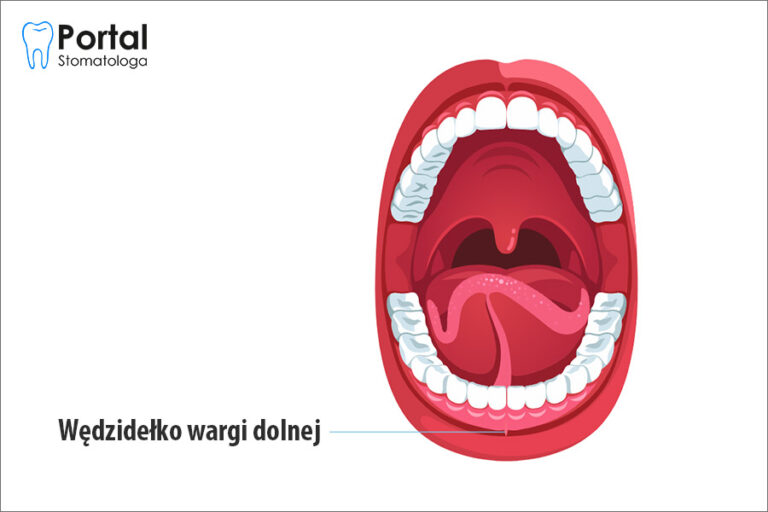 Wędzidełko wargi dolnej
