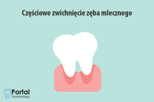Częściowe zwichnięcie zęba mlecznego