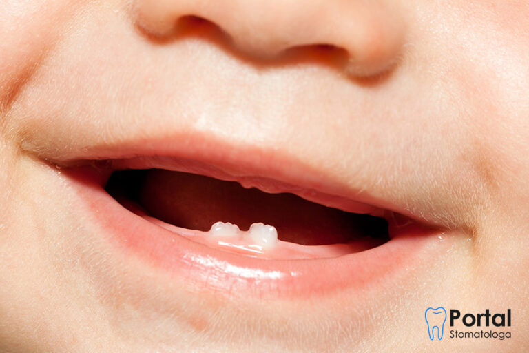 Do kiedy wychodzą zęby mleczne?