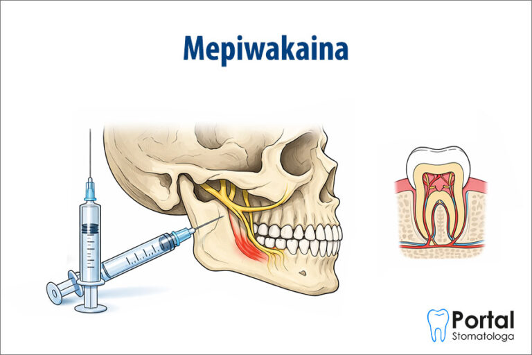 Mepiwakaina