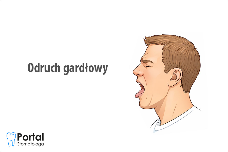 Odruch gardłowy