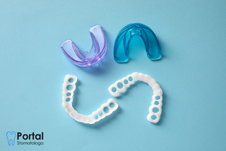 Ortodontyczny ochraniacz szczęki