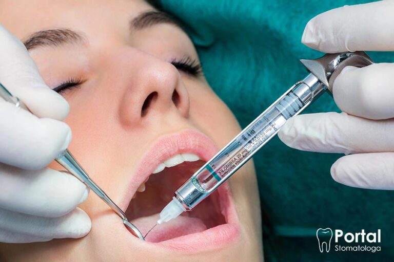 Co zrobić, gdy znieczulenie nie schodzi?