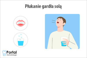 Płukanie gardła solą